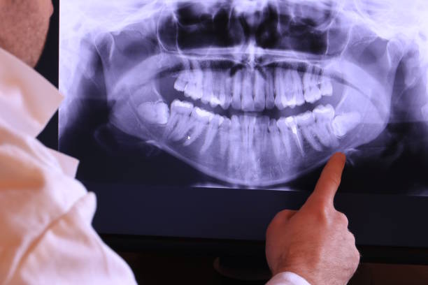 Best Emergency Gum Treatment in Coal Grove, OH