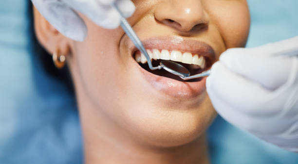 Best Emergency Dental Care for Broken or Chipped Teeth in Coal Grove, OH