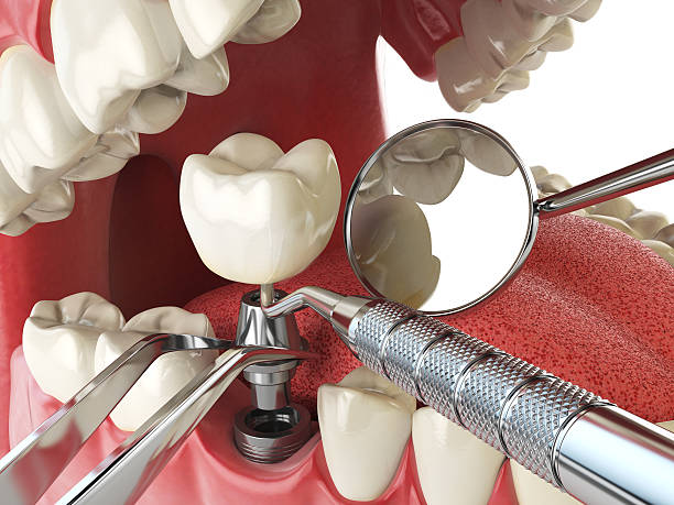 Best Emergency Denture Repair in Coal Grove, OH